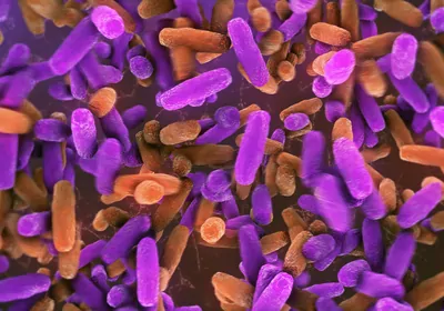 Bright purple and orange lactobacillus bacteria.